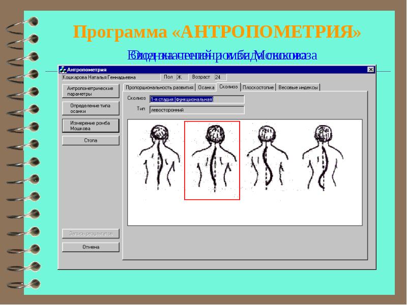 Включи замри. Антропометрия. Программы антропометрии. Структура антропометрии схема. Клиническая антропометрия.