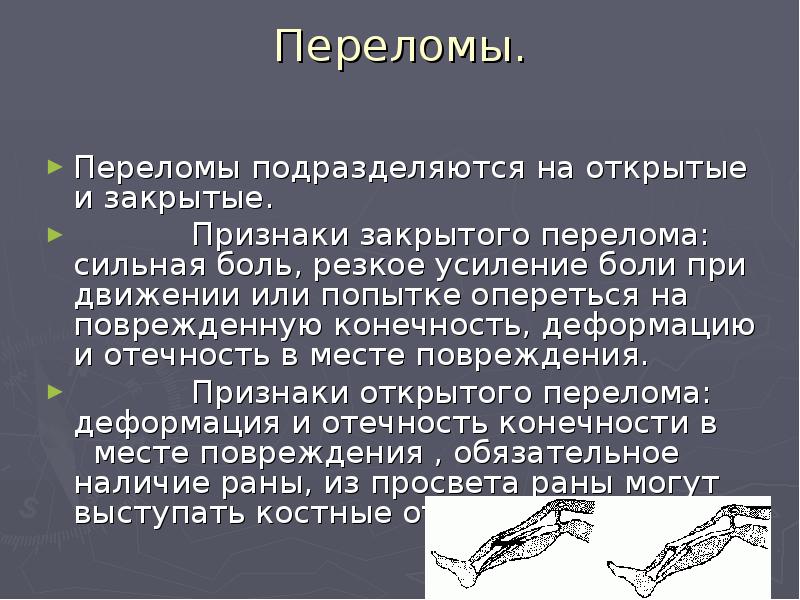 Закрытый перелом симптомы