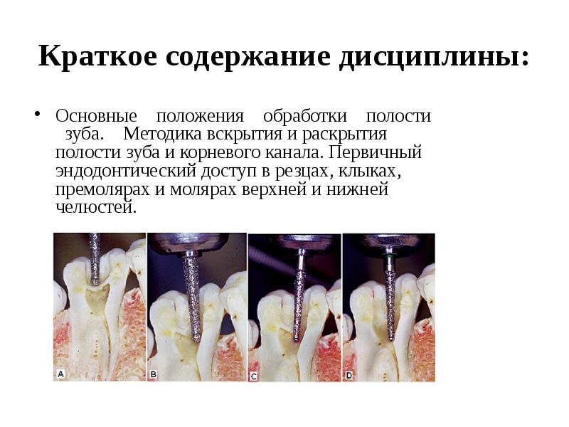 Регенеративная эндодонтия презентация