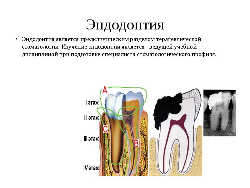 Презентации по эндодонтии