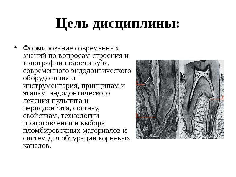 Методы лечения периодонтита презентация