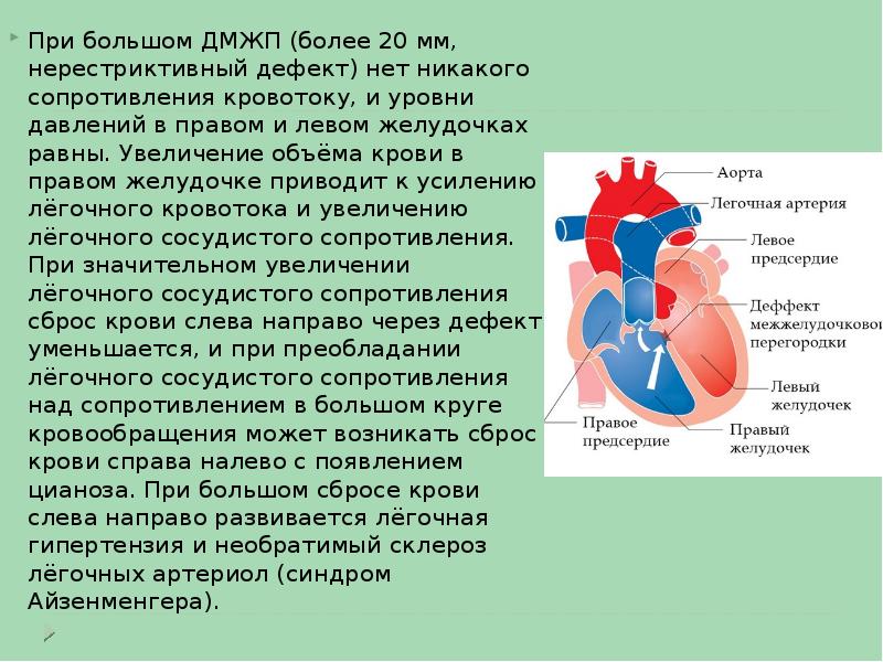 Дмжп у плода