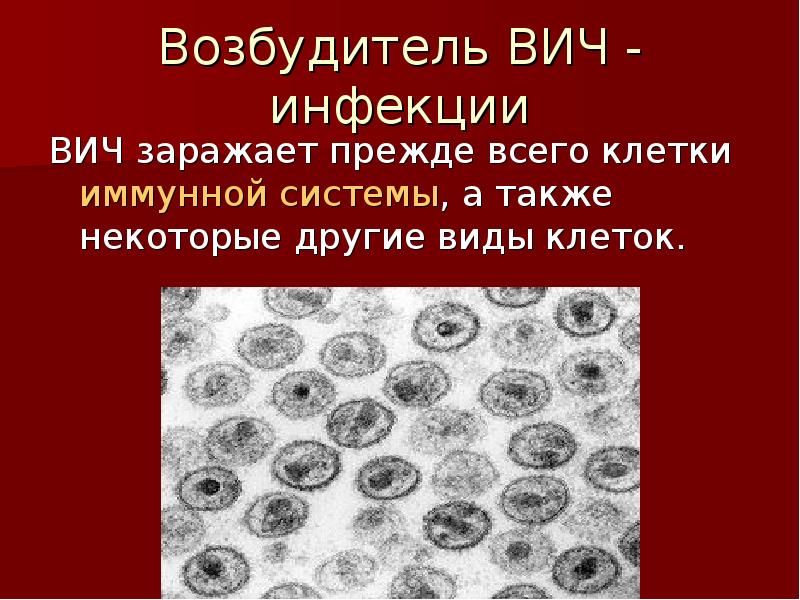 Вирус иммунодефицита человека возбудитель. ВИЧ возбудитель. Характеристика возбудителя ВИЧ инфекции. ВИЧ инфекция особенности возбудителя. Возбудитель ВИЧ инфекции фото.