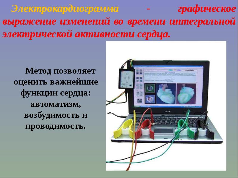 Экг презентация терапия