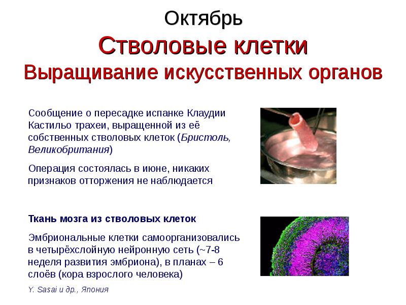 Искусственные органы презентация