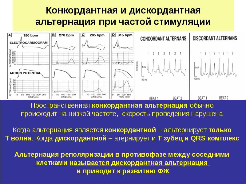 Конкордантный подъем st