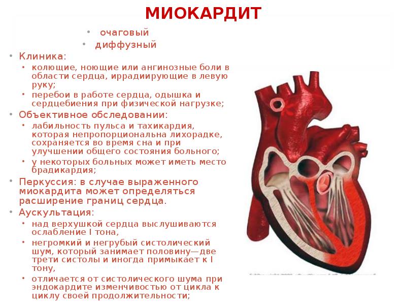 Миокардит это. Клиника эндокардита, миокардита, перикардита. Диффузный миокардит аускультация. Миокард перикард эндокардит.