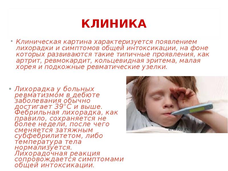 Клиническая картина лихорадки