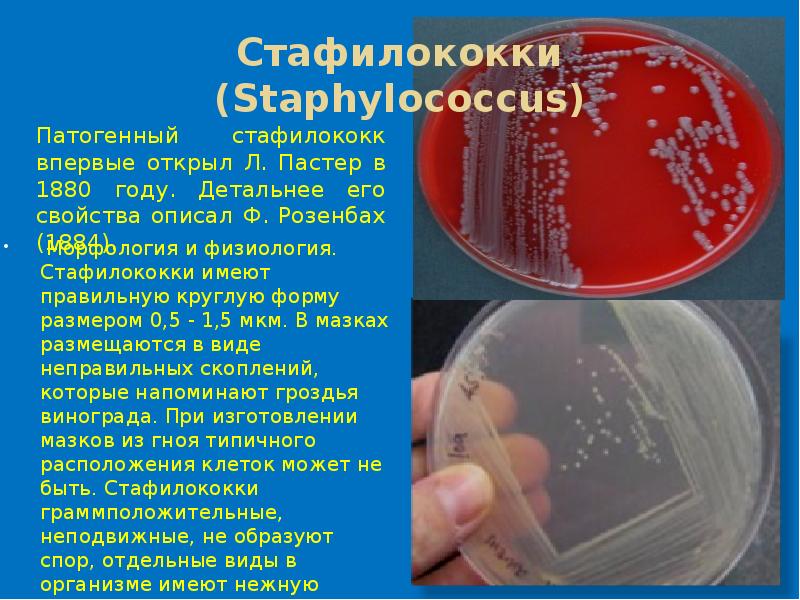 Staphylococcus aureus среда. Стафилококк на ЖСА И кровяном агаре. Рост стафилококка на кровяном агаре. Стафилококки микробиология. Рост золотистого стафилококка на кровяном агаре.