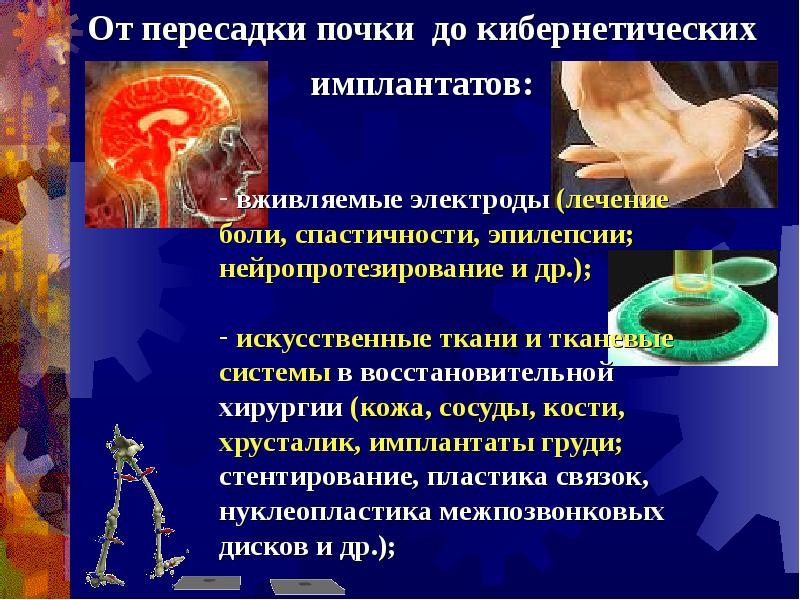 Искусственные органы презентация