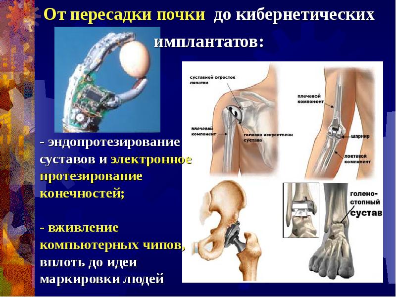 Проект на тему искусственные органы