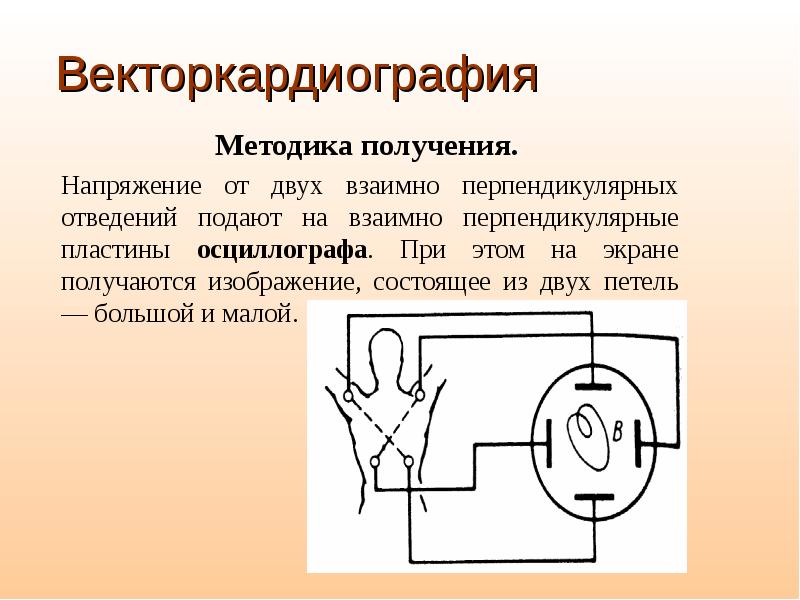 Методика получения. Векторкардиография. Векторкардиография фото. Векторкардиография физиология. Векторкардиография метод.