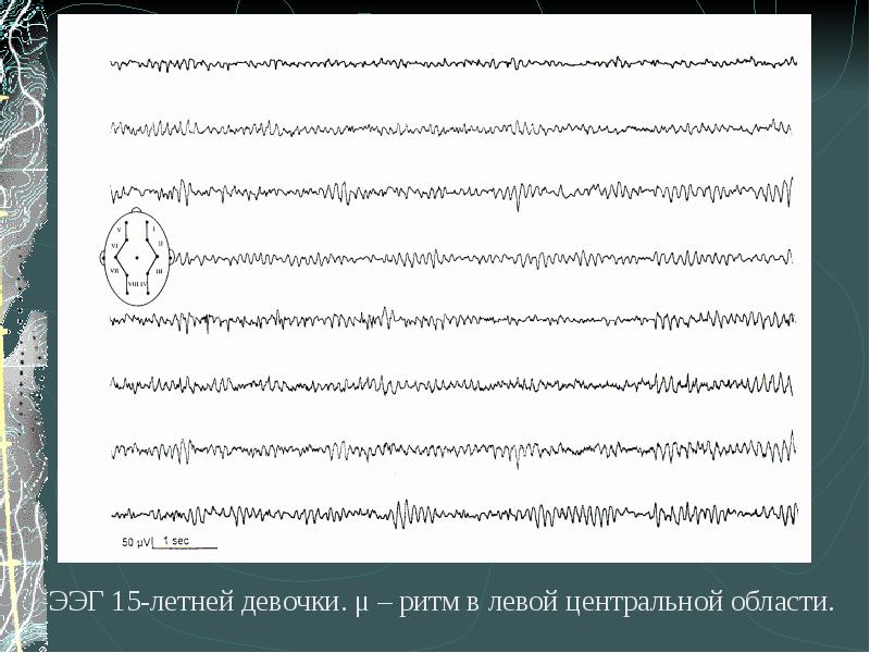 Для чего девушке филологу нужен был электроэнцефалограф. ЭЭГ Центральный области. ЭЭГ логотип. ЭЭГ детей в онтогенезе. ЭЭГ на английском.