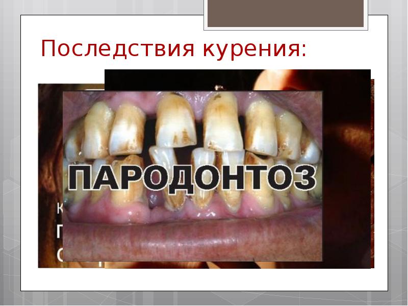 Вредные привычки и их профилактика проект