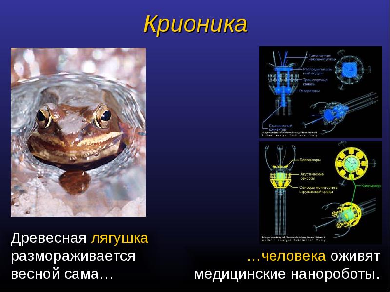 Презентация история крионики