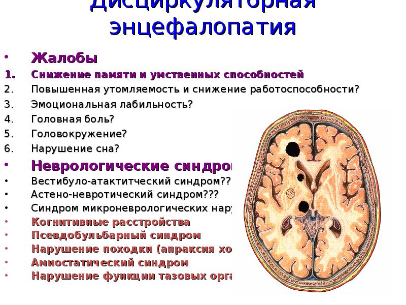 Дисциркуляторной энцефалопатии головного мозга у взрослых что. Дисциркуляторная энцефалопатия неврология. Энцефалопатия головного мозга что это такое. Энцефалопатия основные симптомы.