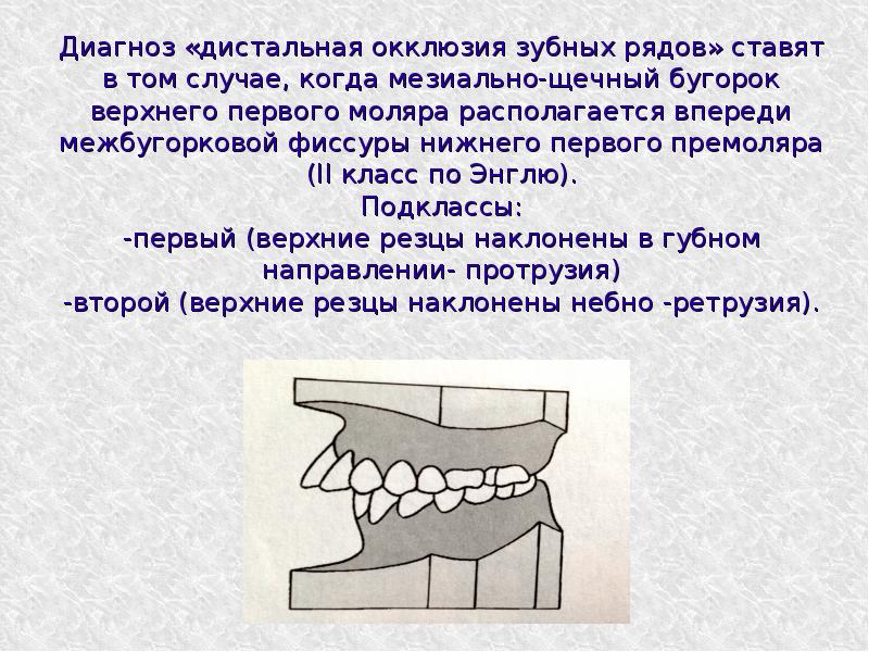 Лечение дистальной окклюзии