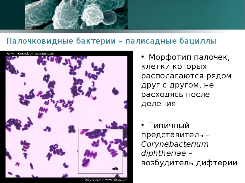 Палочковидную форму имеют бактерии