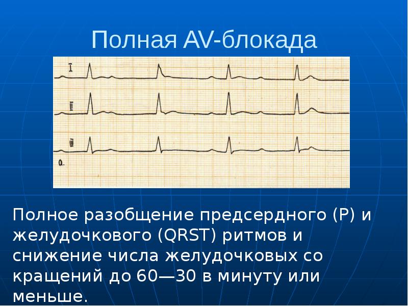 Экг презентация пропедевтика