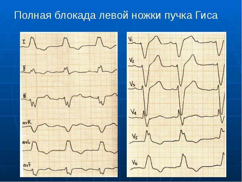 Экг презентация пропедевтика