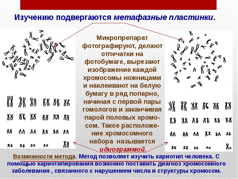 Кариотипы птиц. Метафазные хромосомы человека. Метафазная пластинка. Метафазная пластинка хромосом. Кариотипический анализ метафазных хромосом человека.