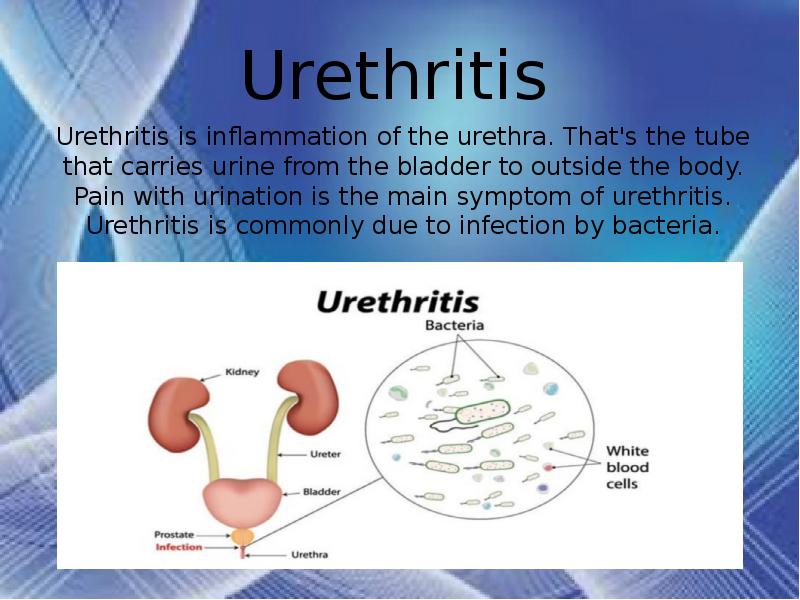 Urethritis латынь. Urethritis латынь. Urethritis латынь. Urethritis латынь. Cystitis herbs.