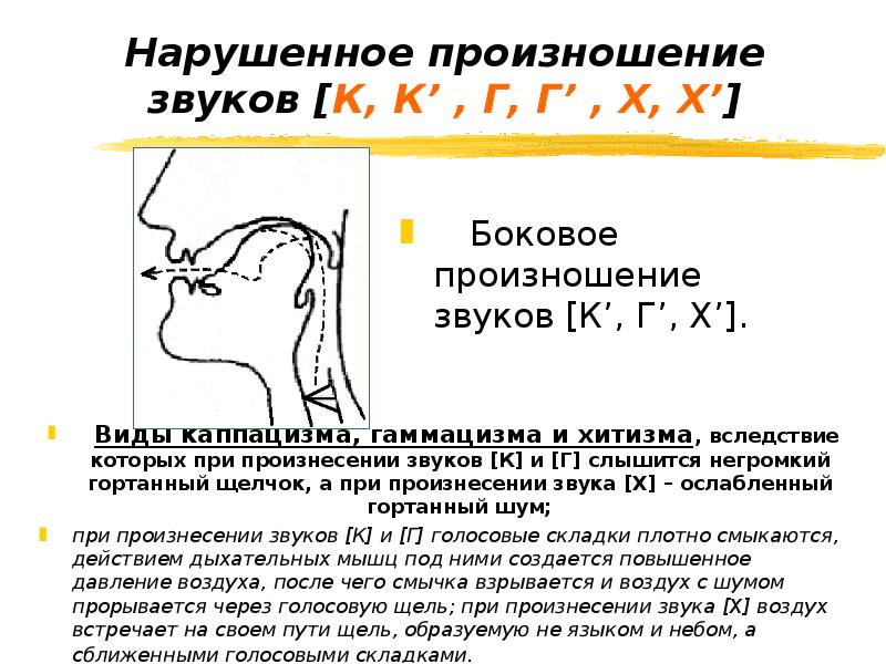 Произношение это. Произношение звуков. Неправильное произношение звуков. Гортанные звуки. Произношение звуков речи.