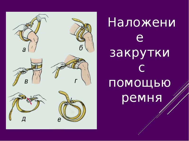 Наложение жгута для остановки кровотечения. Наложение закрутки с помощью ремня. Первая помощь при кровотечениях закрутка. Первая помощь при кровотечениях картинки. Первая медицинская помощь наложение закрутки.