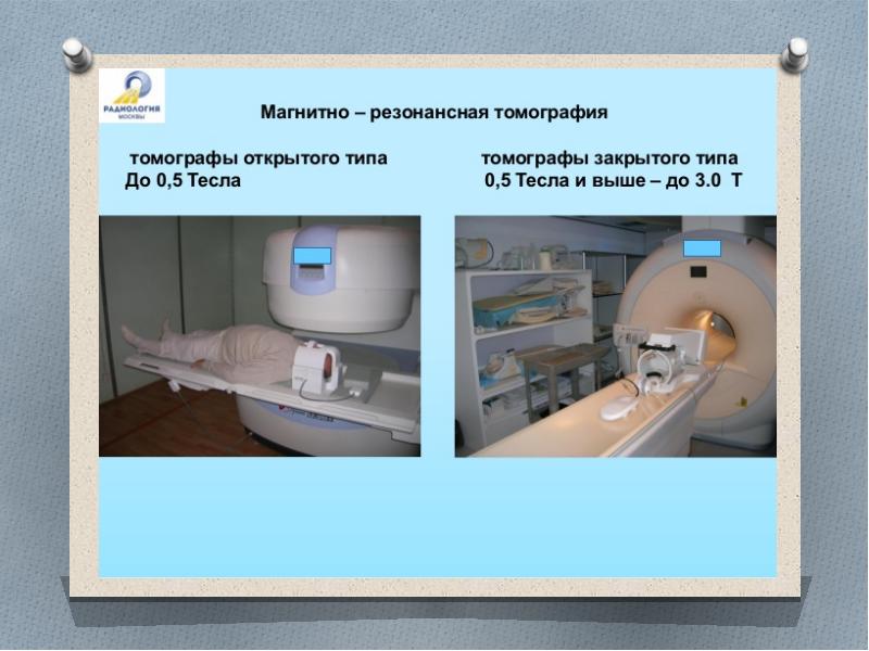 Магнитно резонансная томография презентация