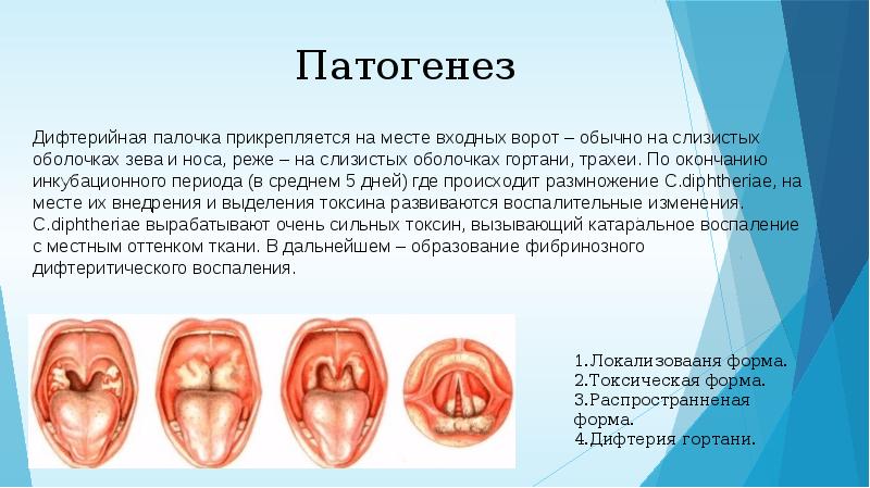 Дифтерия презентация казакша