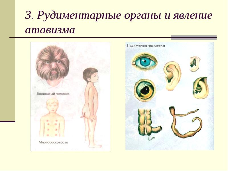 Атавизмы у человека. Рудиментарные органы человека. Атавизмы и рудименты человека. Органы рудименты у человека. Рудиментарные органы животных.