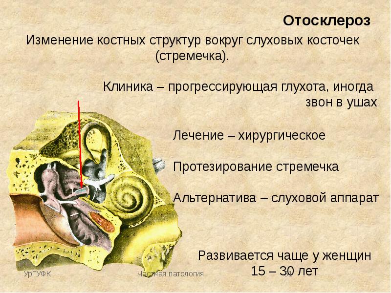 Образец камня неправильной формы весил на воздухе 80 г после покрытия поверхности образца парафином