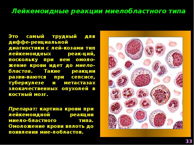 Токсогенная зернистость нейтрофилов