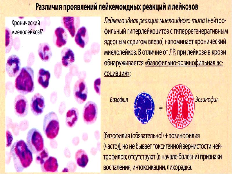 Патология красной крови патофизиология презентация