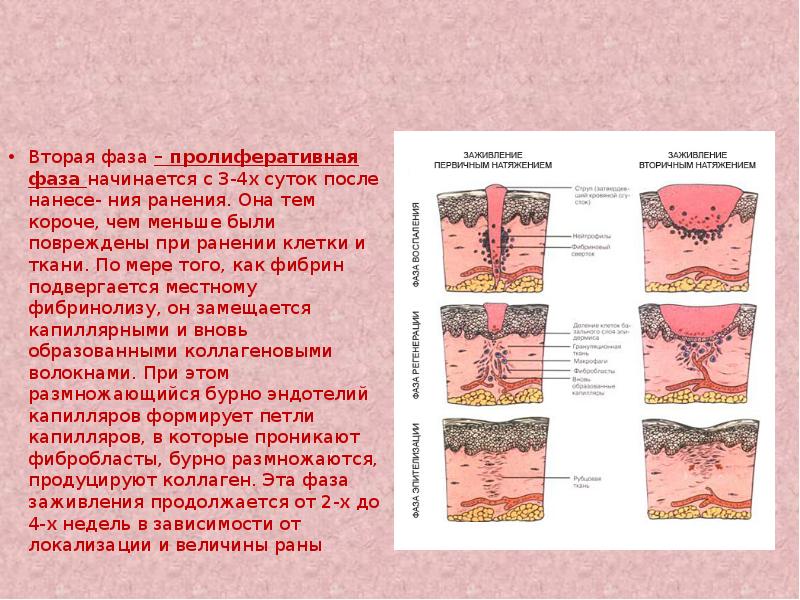 Фазы раневого процесса и раны. Процесс заживления раны. Грануляционная ткань в ране.