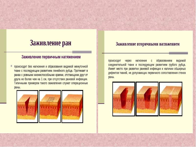 Классификация ран картинки