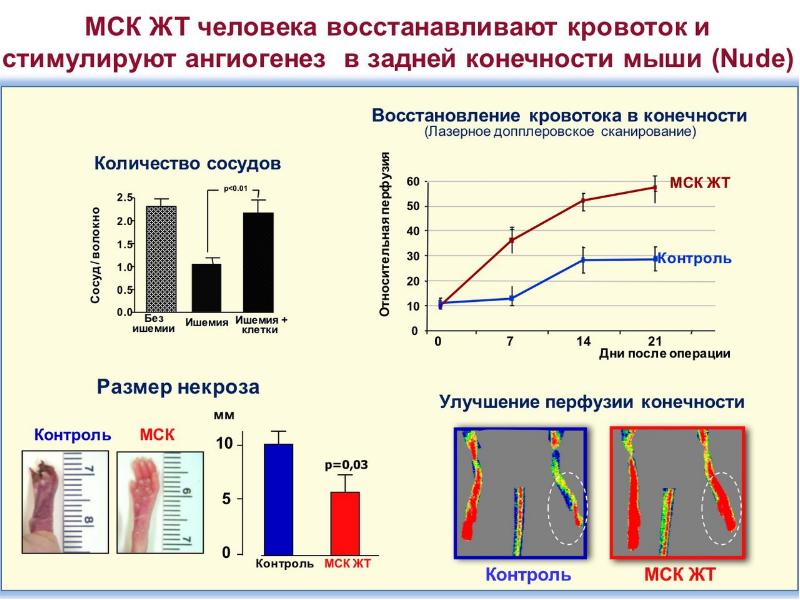 Прогрессивная липодистрофия презентация