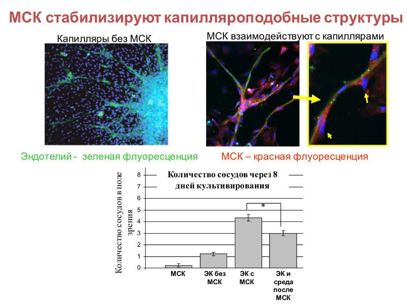 Прогрессивная липодистрофия презентация