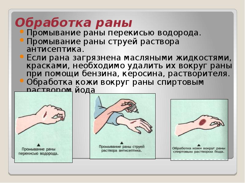 Обработка открытой раны. При обработке раны запрещено. Видео обработки ран. Правила обработки раны. Профилактика нагноений послеоперационных ран.