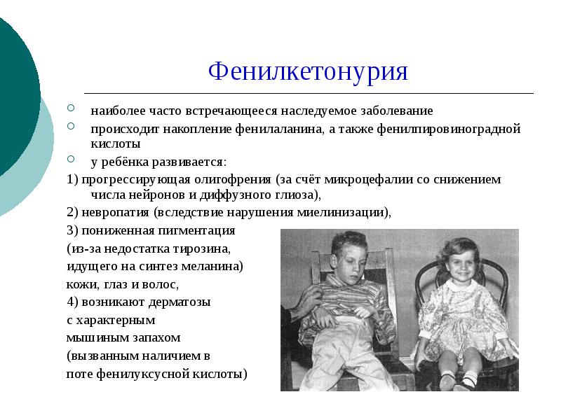 Фенилкетонурия это. Синдром фенилкетонурия Тип наследования. Фенилкетонурия симптомы у детей. Симптомы фенилкетонурии. Дети с заболеванием фенилкетонурия.