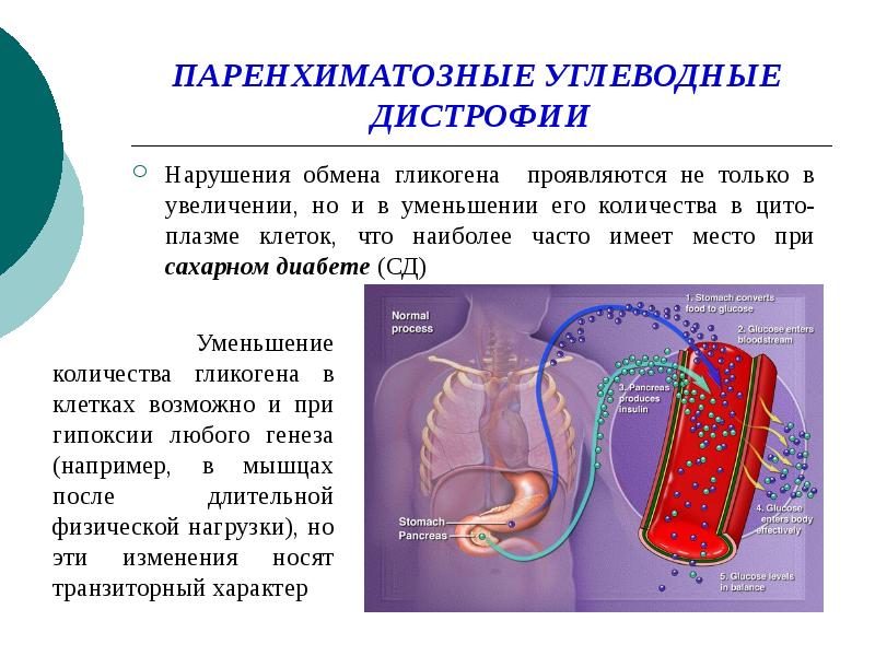 Углеводные дистрофии презентация