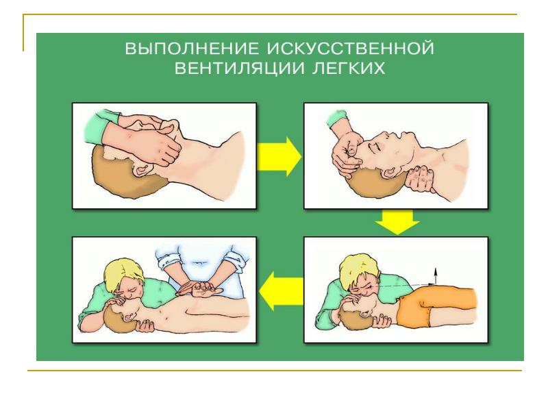 Оказание реанимационной помощи презентация