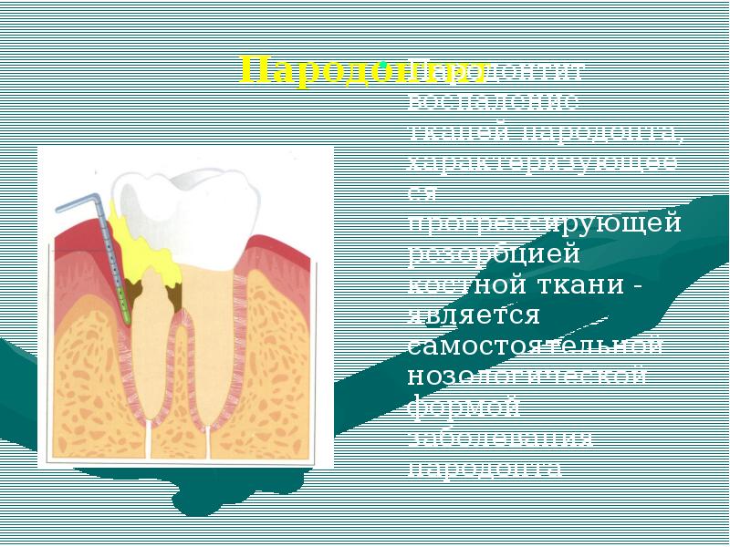 Факторы пародонта