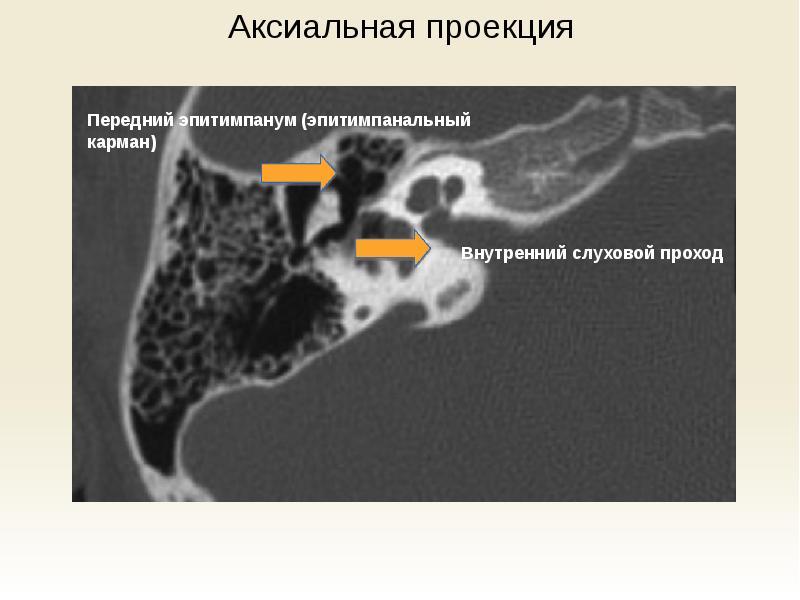 Передняя стенка наружного слухового прохода граничит с тест