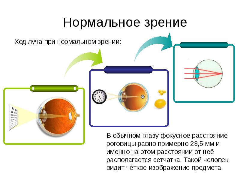 Изображение получаемое на сетчатке глаза с нормальным зрением