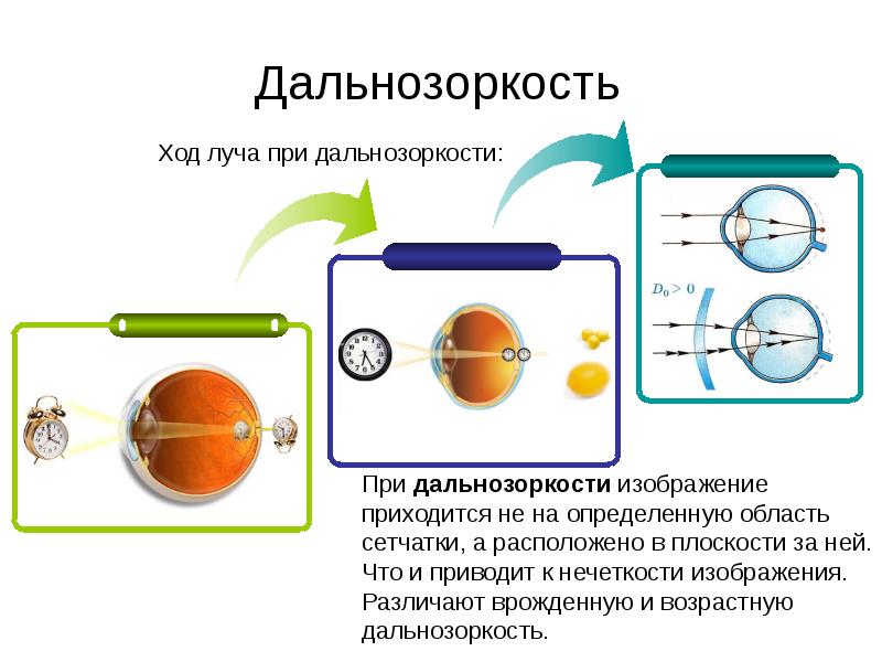 Глаз и зрение близорукость и дальнозоркость физика 8 класс презентация