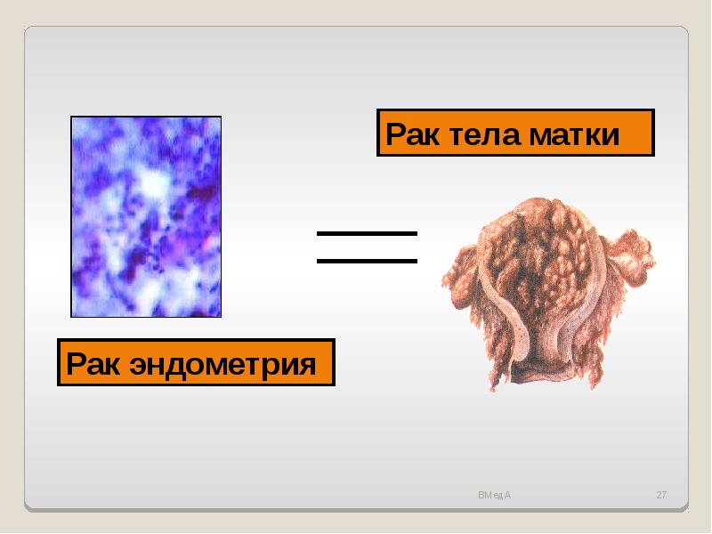 Гиперплазия и рак эндометрия презентация