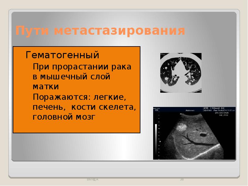 Гиперпластические процессы эндометрия презентация