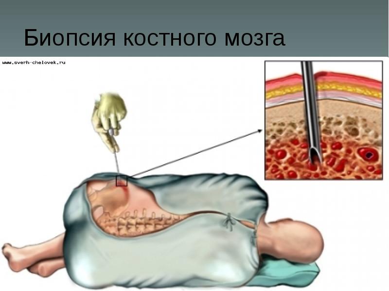 Патологии влагалища фото