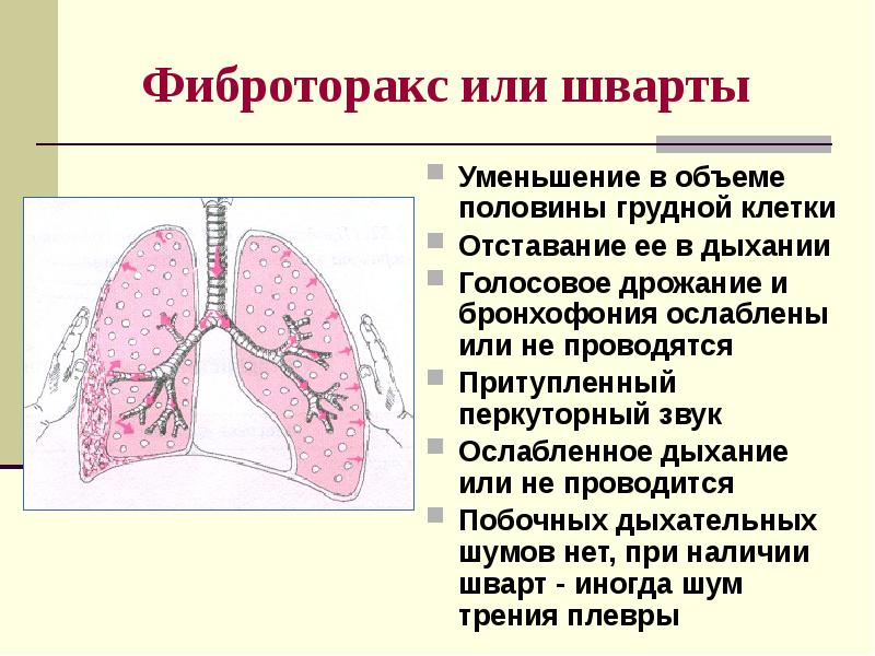 Презентация пропедевтика внутренних болезней дыхательная система